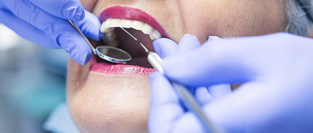 Best Emergency Treatment for Oral Infections in Beaver Dam, WI